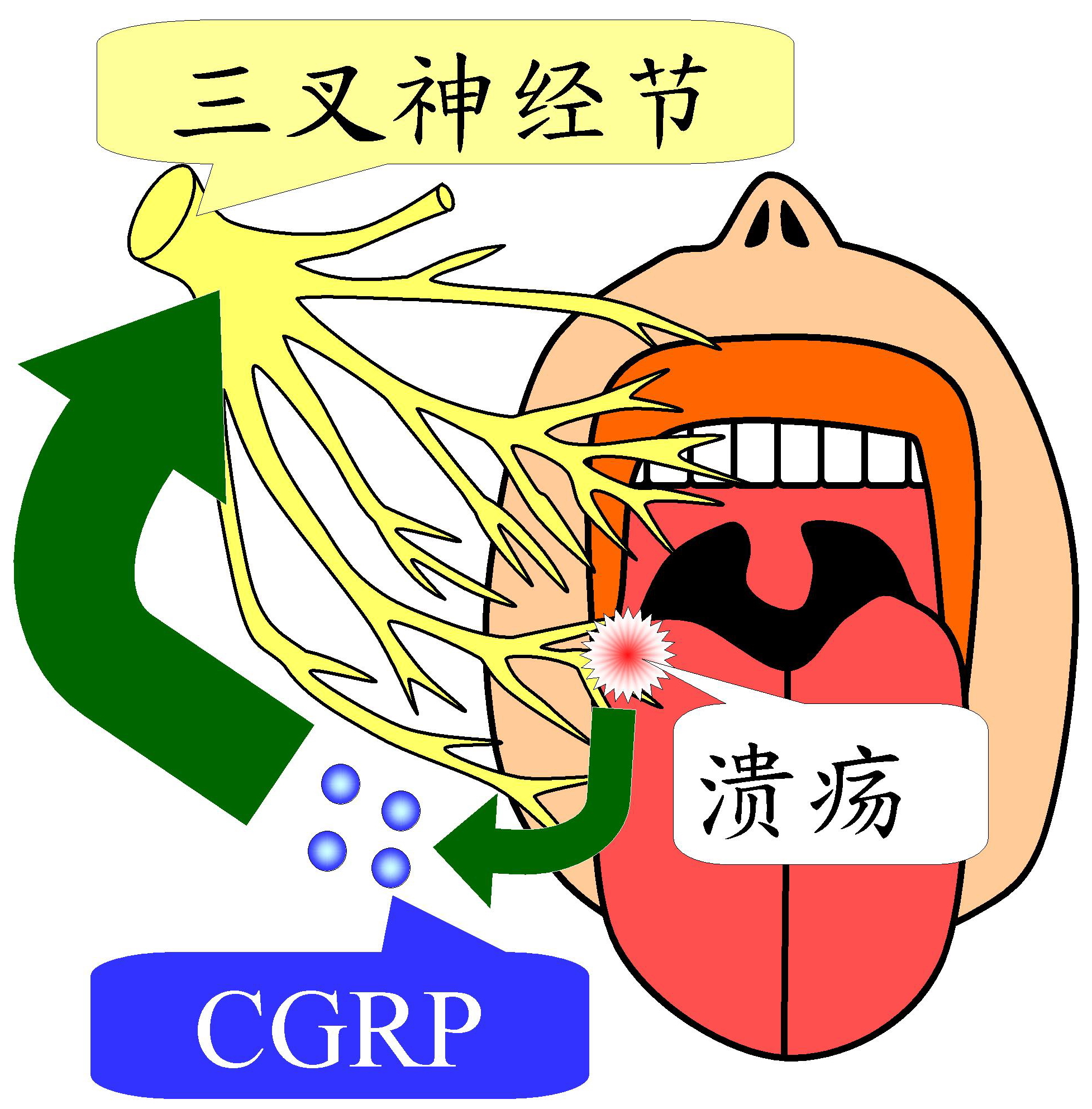 台湾耳鸣眩晕权威分享特殊病例:口腔溃疡引发的神经性偏头痛